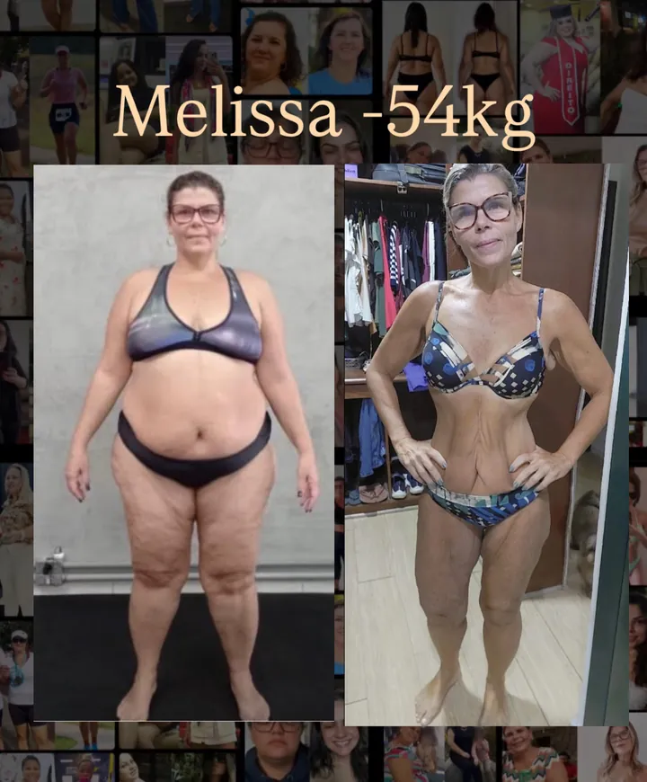 Melissa, antes e depois: menos 54 kg